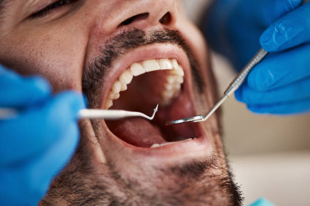 Best Emergency Treatment for Dental Infections or Abscesses in Brittany Farms The Highlands, PA