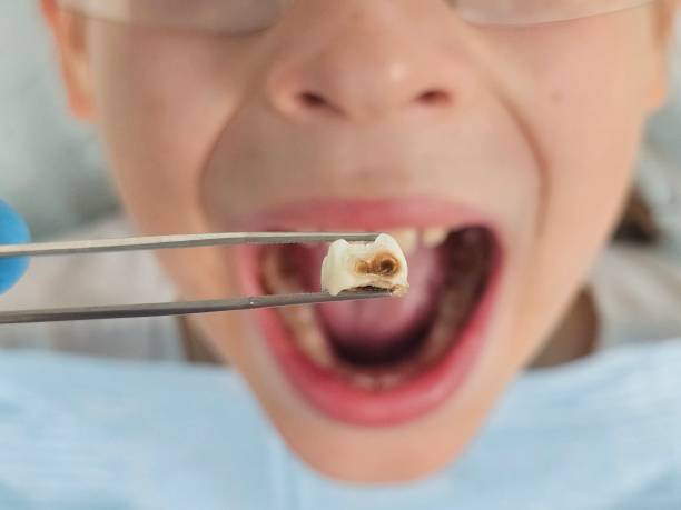 Best 24-Hour Emergency Dentist in Brittany Farms The Highlands, PA
