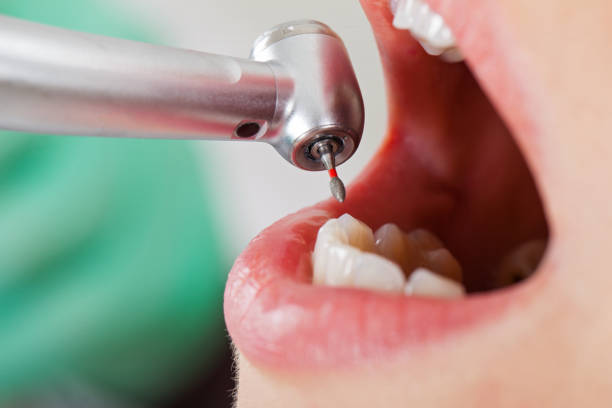 Best Urgent Care for Lost Fillings or Crowns in Brittany Farms The Highlands, PA